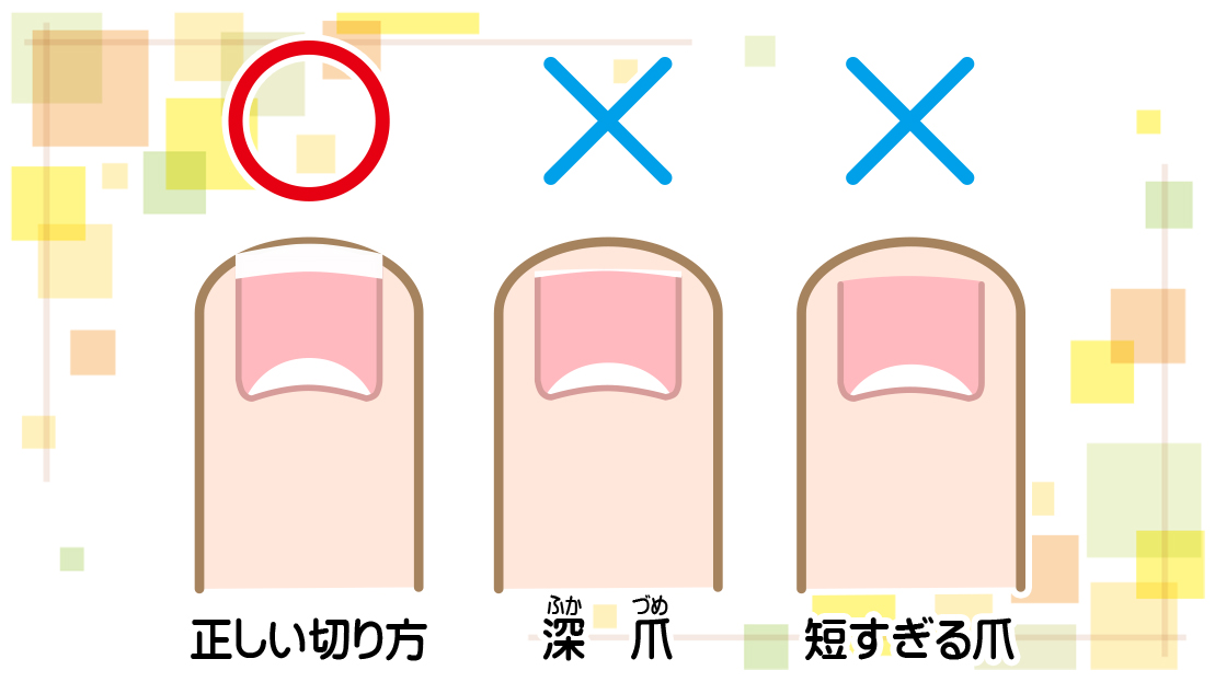 正しい爪の切り方